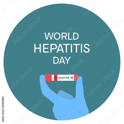 Hand holding laboratory test tubing with blood sample on white background. World Hepatitis Day awareness poster. Medical solidarity symbol. Vector illustration. 