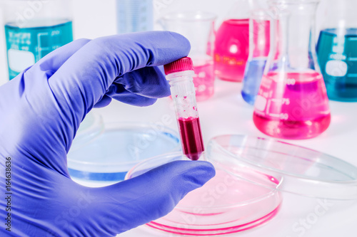 Scientist with blood sample. Medical laboratory.
