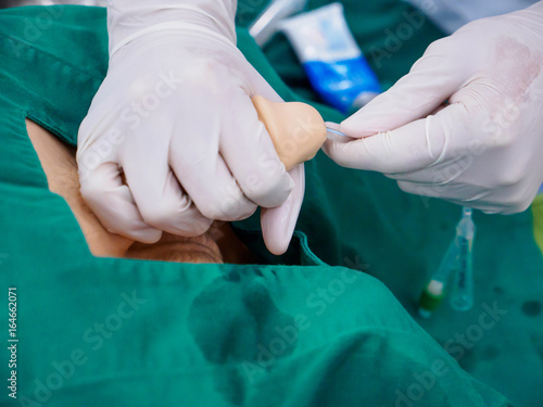Close-up detail of a medical student inserting a foley catheter into the urethra of a dummy model's penis. Healthcare and education concept.