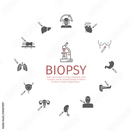 Biopsy: Types of biopsy procedures used to diagnose cancer
