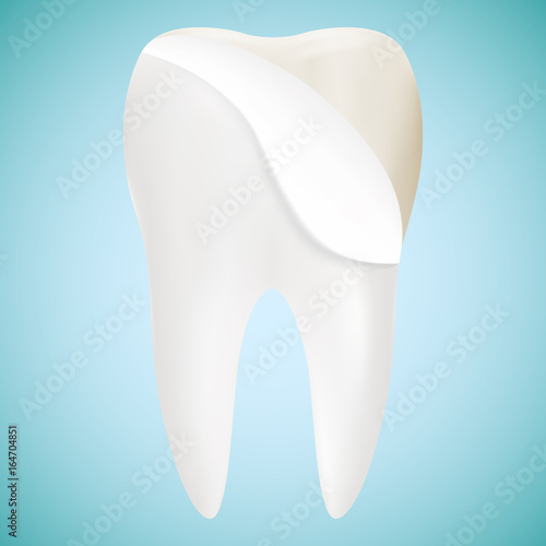 Tooth Veneer Whitening Dental Technician Vector Concept Isolated On A Background. Realistic Vector Illustration. Healthcare stomatology and cleaning professional teeth illustration
