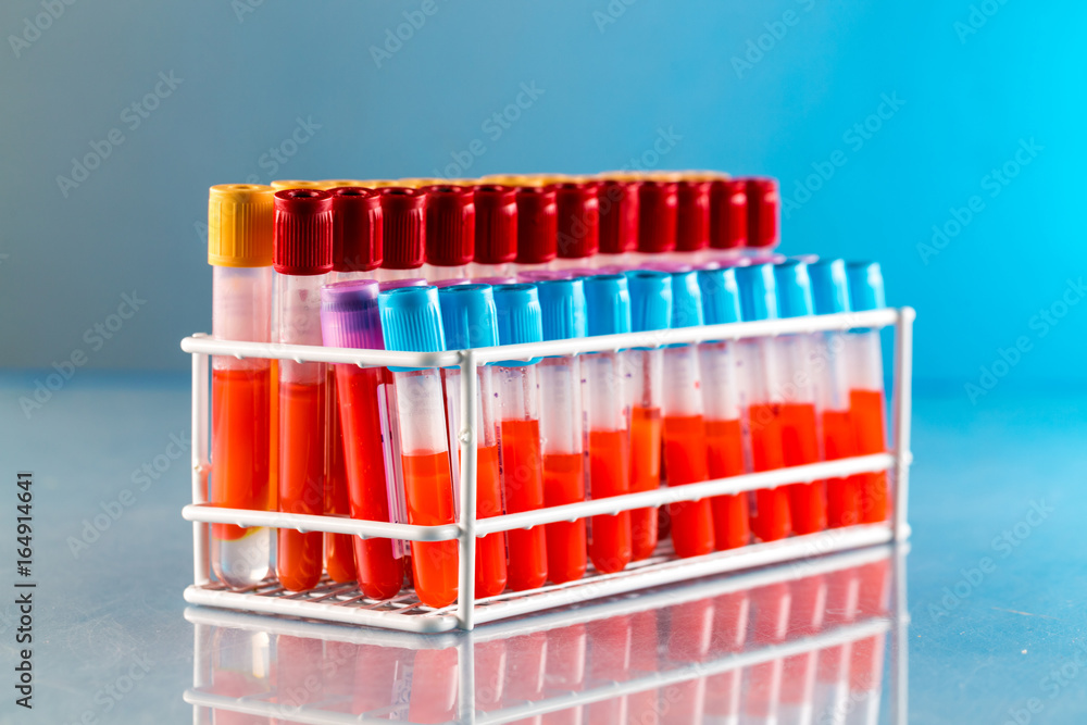 Test tubes with blood for medical and biological analyzes Test tubes with blood for medical and biological analyzes