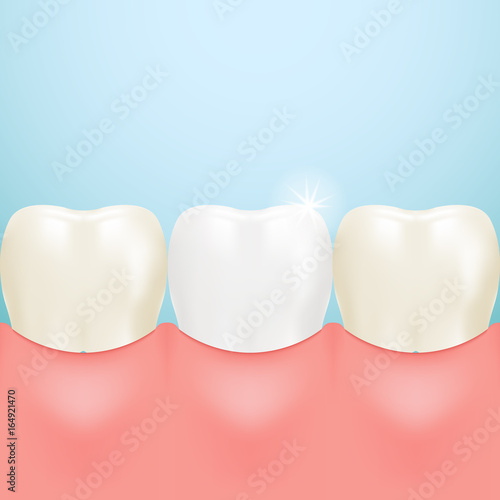 Healthy Tooth, Teeth Whitening Isolated On A Background. Realistic Vector Illustration. Healthcare stomatology and cleaning professional teeth illustration