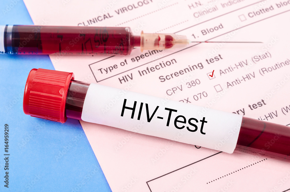 Fototapeta premium Sample blood collection tube with HIV test.