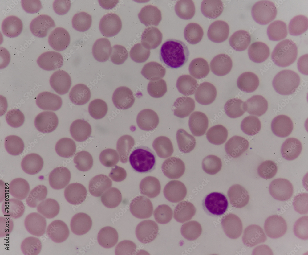 blood cells with microscope. blood cells with microscope.