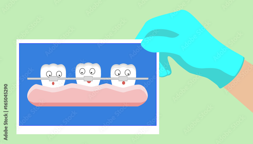 tooth cartoon vector, orthodontics teeth or dental braces tooth cartoon vector, orthodontics teeth or dental braces