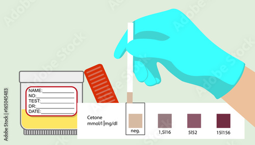 Acetone test. Medical express test. Ketones. Diagnostic test