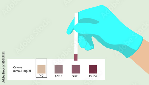Acetone test. Medical express test. Ketones. Diagnostic test