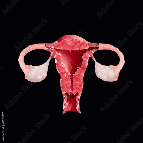 polygonal uterus