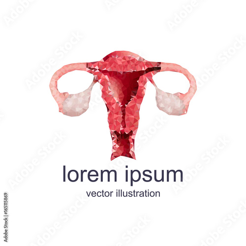 polygonal uterus