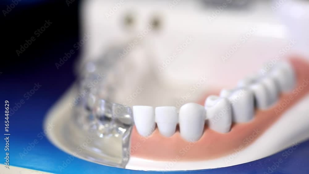 Dentatura di plastica Dentatura di plastica