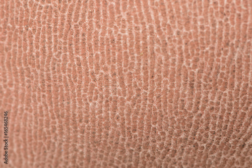dry foot skin texture