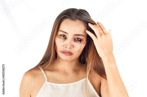 Wallpaper Mural Young Asian woman with Bruise on the face. Gender issue or criminal violence concept  Torontodigital.ca