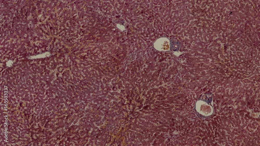 human liver cells under a microscope zoom in animation human liver cells under a microscope zoom in animation
