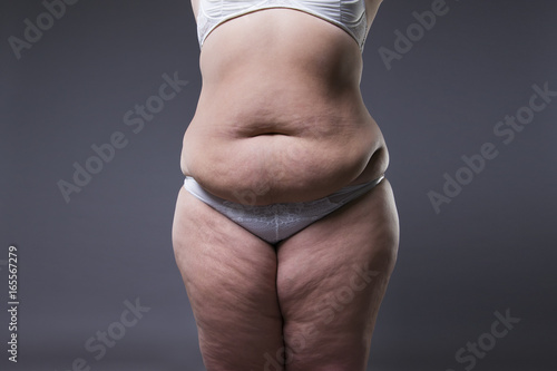 Woman with fat abdomen, overweight female stomach