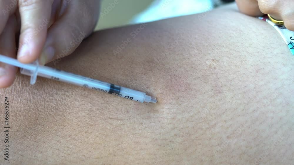 Close up of female injecting insulin into the leg, diabetes
Close up of female injecting insulin into the leg, diabetes