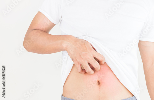 Wallpaper Mural Young man scratch the itch on him belly, Healthcare concept. Torontodigital.ca