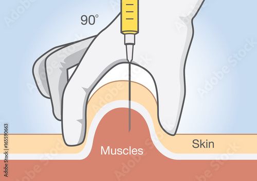 Doctor insert medications into the muscle tissue with injection needle.