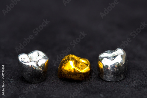 Dental  gold and metal tooth crowns on dark black surface.