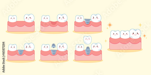 cartoon tooth implant smile happily