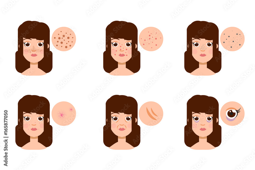 Woman with skin problem, acne. Vector illustration Woman with skin problem, acne. Vector illustration
