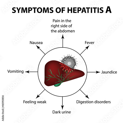 Symptoms of hepatitis A. Liver. Virus. Infographics. Vector illustration on isolated background.