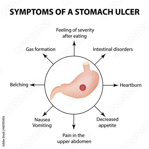 1235444 Symptoms of a stomach ulcer. Infographics. Vector illustration on isolated background