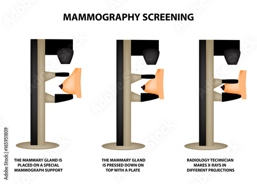 Stages of mammography. Mammographic screening. Mammogram apparatus. World Breast Cancer Day. Infographics. Vector illustration on isolated background.