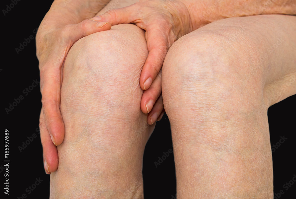 Senior woman holding the knee with pain Senior woman holding the knee with pain