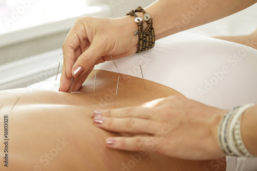Master is injecting steel needles during procedure of acupuncture therapy