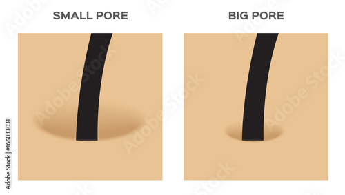 wide and small hair follicle , pore . skin vector