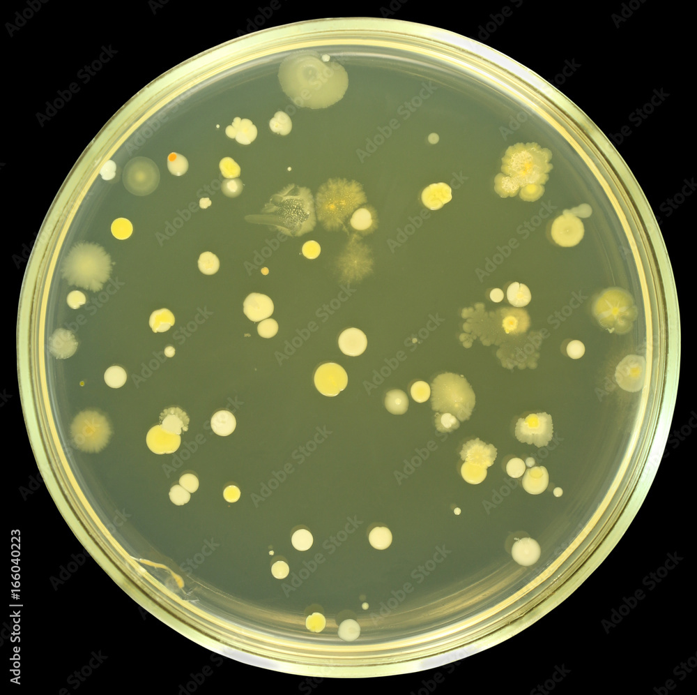 Colonies Of Bacteria From Air On A Petri Dish Agar Plate Isolated On ...