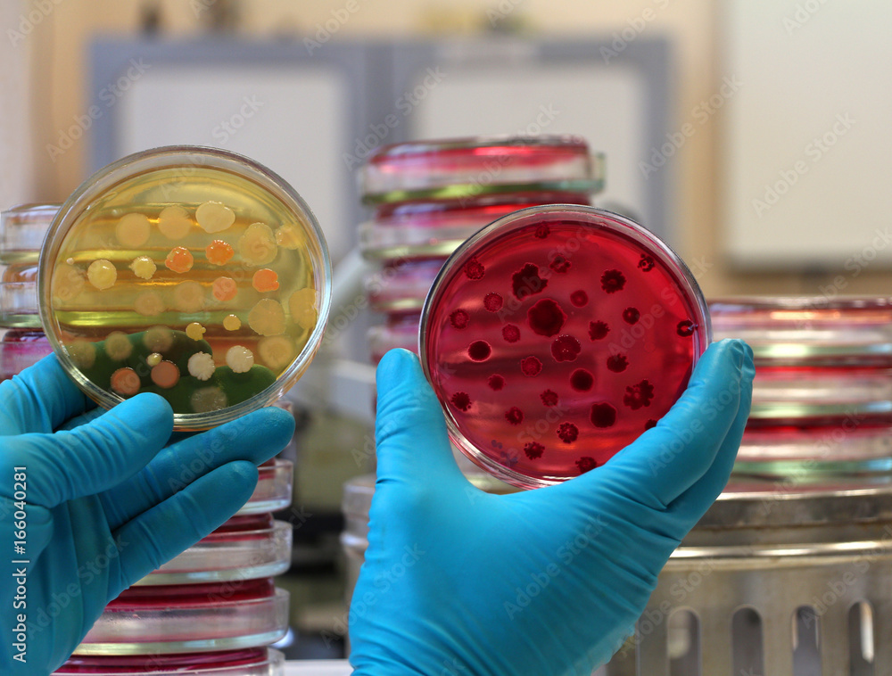 Doctor holding two different petri plates and compares bacterial ...