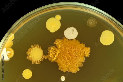 Colorful bacterial colonies close up. Different microbes  on meat-peptone agar in petri dish. Isolation on black.