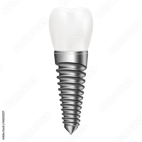 Dental Implant Isolated On A White Background. Vector Illustration. Stomatology. Creative Medical Concept