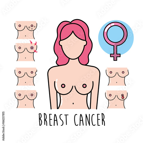 set breast cancer sickness and medicine treatment