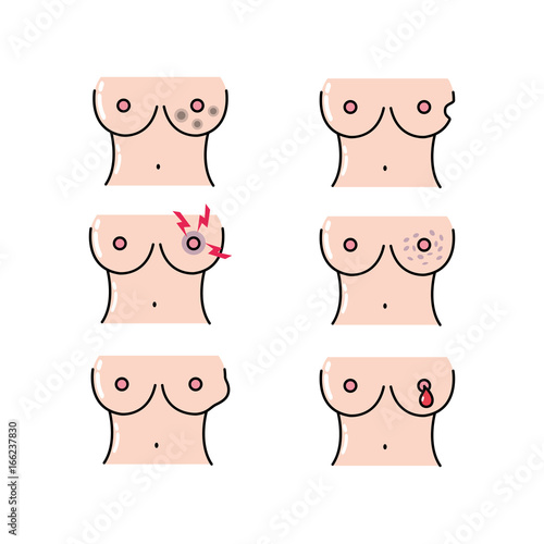 set breast cancer sickness and medicine treatment