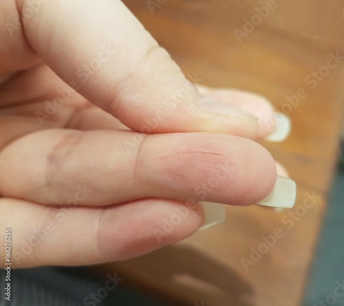 Foreground close up image of a cut on a girl s finger with blur background