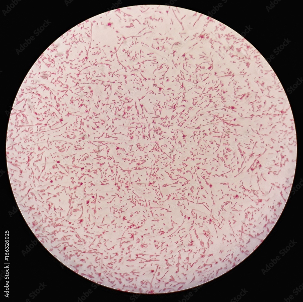 Smear of gram negative bacilli bacteria under 100X light microscope (Selective focus). Stock Photo | Stock