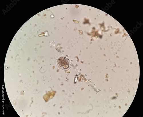 Hookworm egg in stool examination, under 40X light microscope.