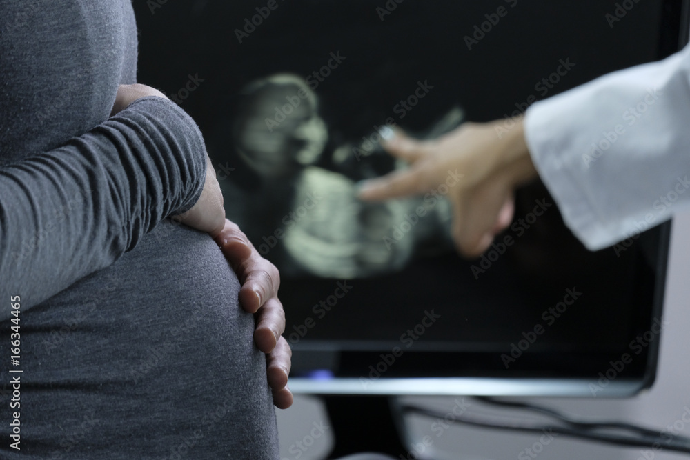 Doctor showing ultrasound image to pregnant woman
