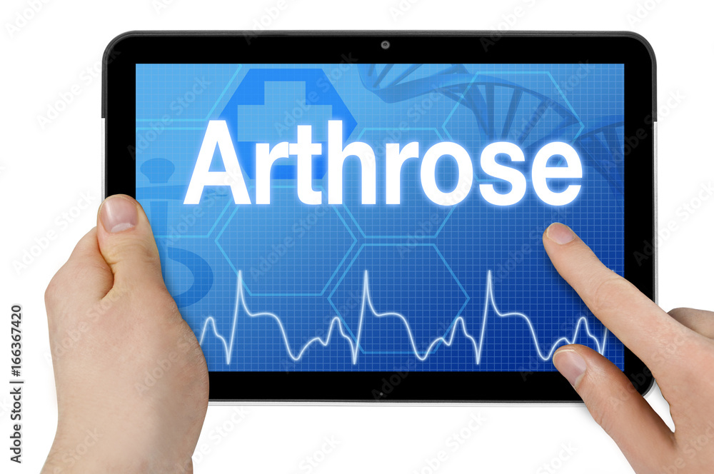 Tablet mit Diagnise und Arthrose Tablet mit Diagnise und Arthrose