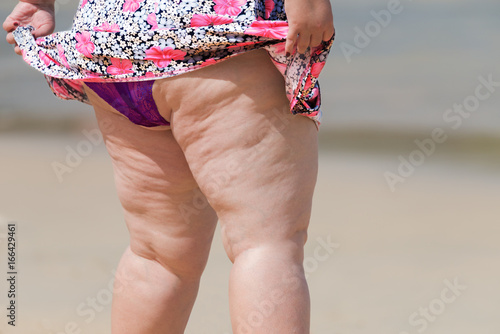 Lively old fat woman in swimwear on sunny beach Cellulite thigh