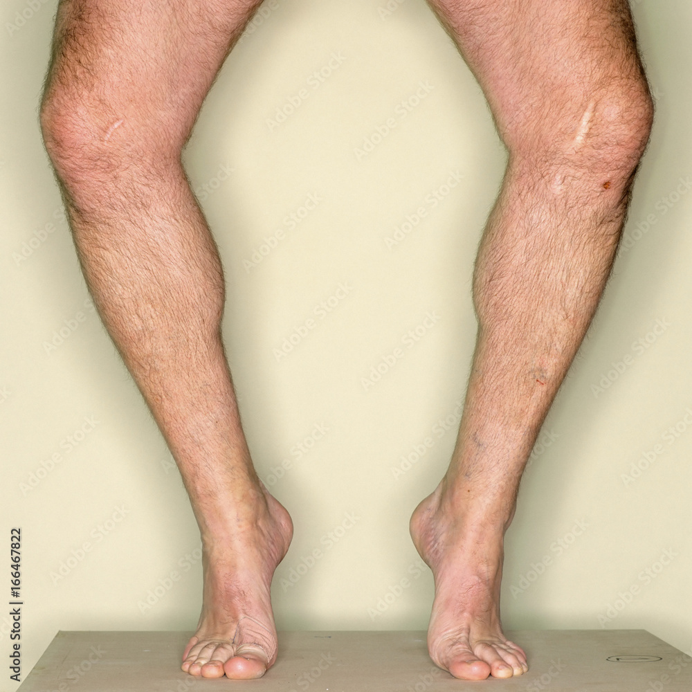 Male legs Photos | Adobe Stock