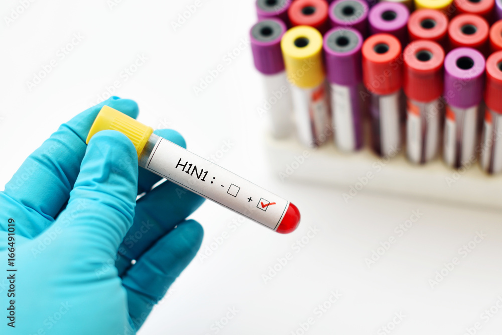 Fototapeta premium Blood sample positive with H1N1 influenza virus