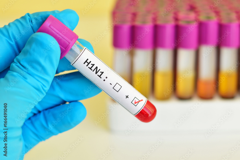 Obraz premium Blood sample positive with H1N1 influenza virus 