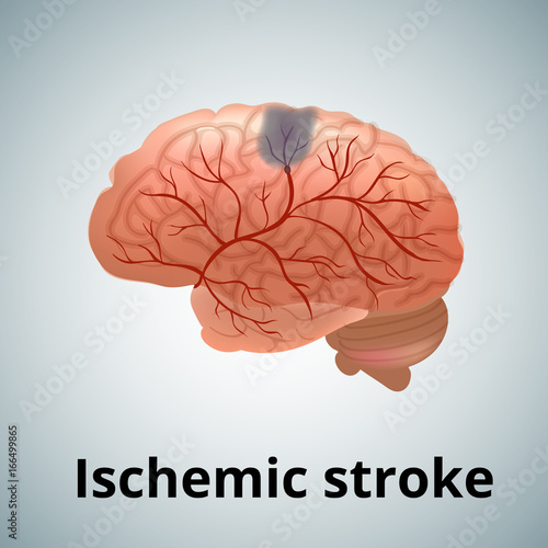 Realistic human sick brain isolated on white background.