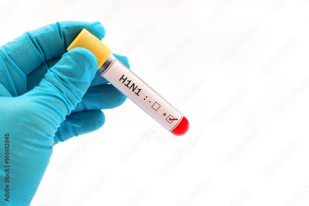 Obraz premium Blood sample positive with H1N1 influenza virus 