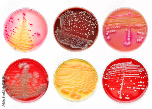 Mixed of bacteria colonies in various petri dish
 photo