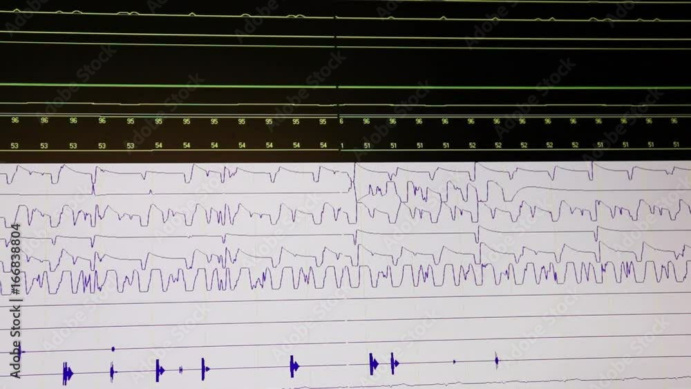 Black and white monitor screen with moving lines. Black and white monitor screen with moving lines.